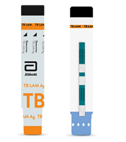 Determine TB LAM Ag